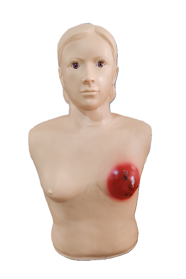 高级乳痈诊断训练模型